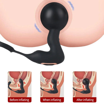 Inflatable Anal Plug USB รีโมทคอนโทรล Anal ของเล่น Inflatable Prostate Massager DELAY ล็อค Sperm แหวนผลิตภัณฑ์สําหรับผู้ใหญ่เพศของเล่น